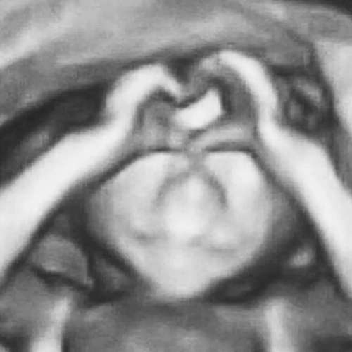 Ir para  <p><big>No s&eacute;timo m&ecirc;s gestacional, a fisioterapeuta&nbsp;<strong>Ludimila Pereira</strong>, de 24 anos, compareceu em mais uma consulta mensal de pr&eacute;-natal na Maternidade...