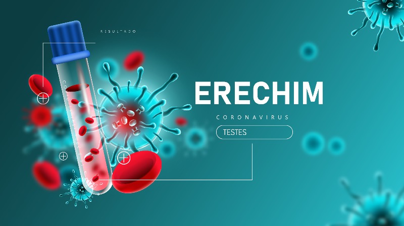 Ir para  <p><big>A Secretaria&nbsp;Municipal de Sa&uacute;de de Erechim, em parceria com a Universidade Federal da Fronteira Sul (UFFS) realizou nos dias 10,11 e 12 de julho um projeto in&eacute;dito de testagem r&aacute;pida...