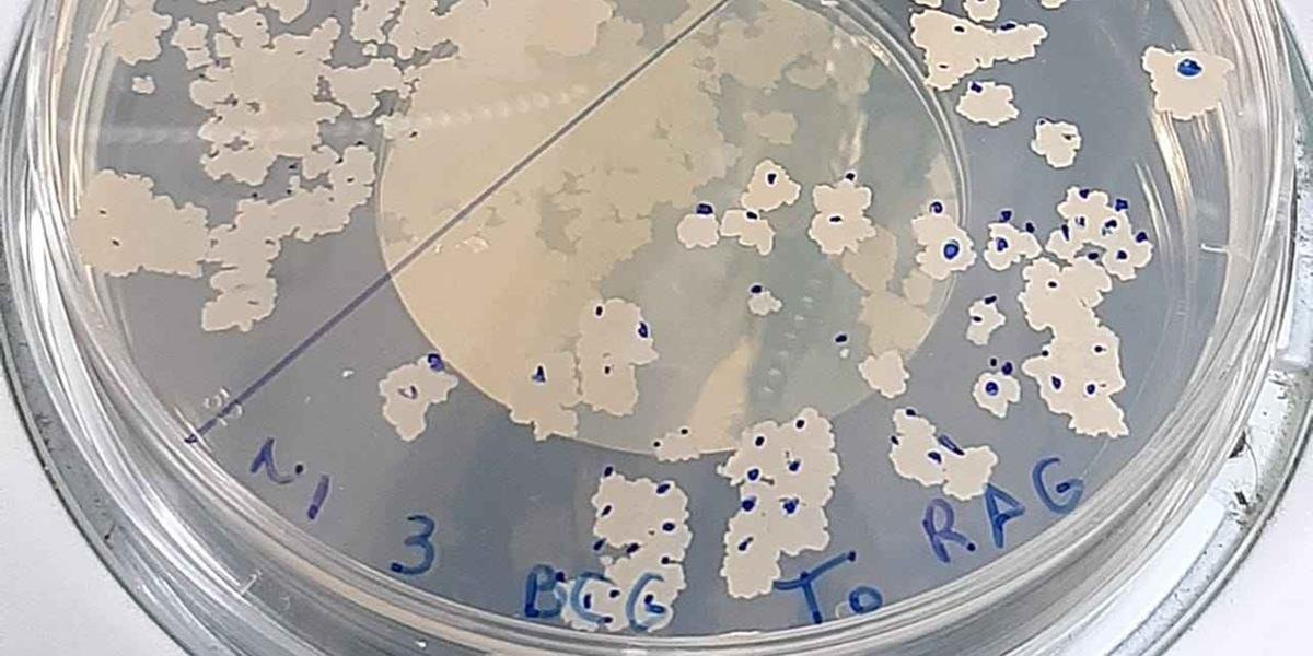 Ir para  <p>Pesquisadores brasileiros est&atilde;o estudando a possibilidade de usar a vacina BCG, que serve para combater a tuberculose, contra a Covid-19 - o que daria prote&ccedil;&atilde;o contra as duas doen&ccedil;as ao mesmo...
