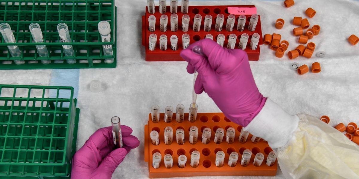 Ir para  <p>A corrida fren&eacute;tica para descobrir uma vacina contra a Covid-19 provocou a disparada nos pre&ccedil;os das a&ccedil;&otilde;es de v&aacute;rios laborat&oacute;rios no mundo, ao mesmo tempo que jovens...