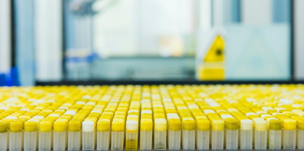 Ir para  <p>O Brasil retomou nesta segunda-feira os testes da vacina contra a Covid-19 desenvolvida pela Universidade de Oxford em parceria com o laborat&oacute;rio AstraZeneca. Em comunicado, a Universidade Federal de S&atilde;o Paulo...