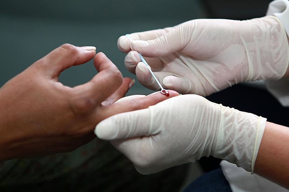 Ir para  <p><big>O governo de Jair Bolsonaro voltou a atacar os programas de pol&iacute;ticas p&uacute;blicas de sa&uacute;de, agora por meio da suspens&atilde;o de todos os exames de genotipagem de HIV e hepatite C,...