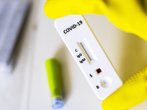 Ir para  <p><big>O Brasil tem 58 casos suspeitos de reinfec&ccedil;&atilde;o pelo coronav&iacute;rus em nove Estados, segundo o Minist&eacute;rio da Sa&uacute;de informou nesta sexta-feira (11). &ldquo;As amostras...