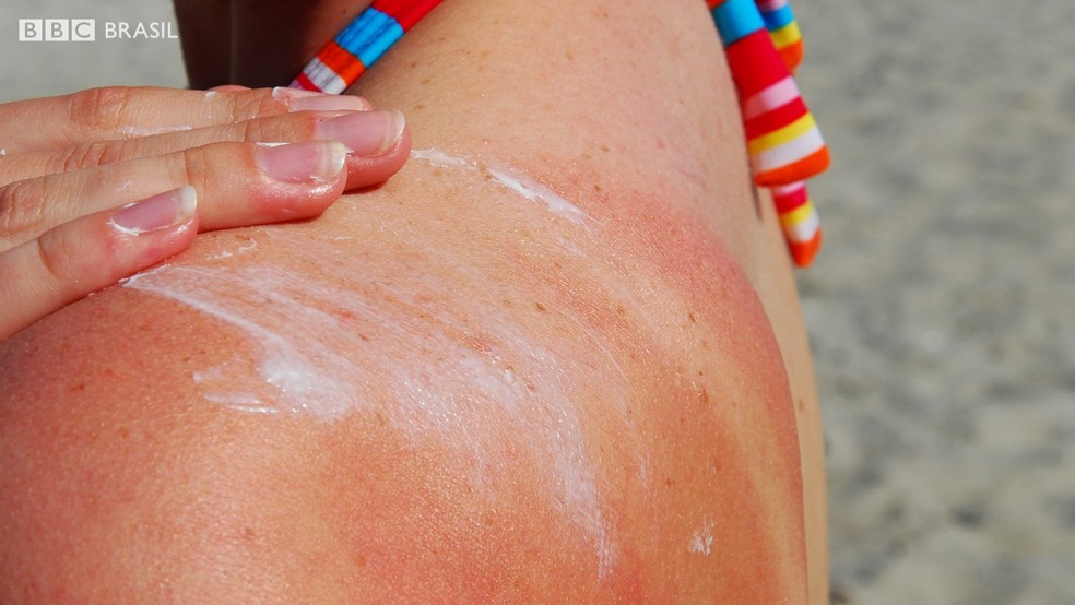 Ir para  <p><big>Segundo a Sociedade Brasileira de Dermatologia (SBD), o c&acirc;ncer de pele &eacute; o tipo mais frequente no mundo e corresponde a 27% de todas as neoplasias malignas no Brasil. Isso porque, de acordo com...