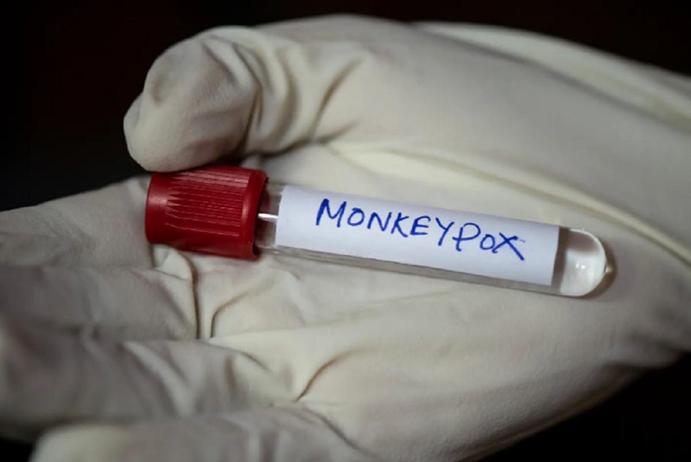 Ir para  <p><big>A transmiss&atilde;o comunit&aacute;ria da Monkeypox no Rio Grande do Sul foi confirmada nesta quinta-feira (18/8), pela Secretaria da Sa&uacute;de (SES). Essa situa&ccedil;&atilde;o ocorre quando...